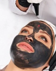 carbon facial dehradun